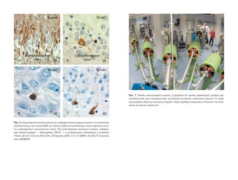 Революция в голове. Как новые нервные клетки омолаживают мозг, Кемперманн Герд купить книгу в Либроруме